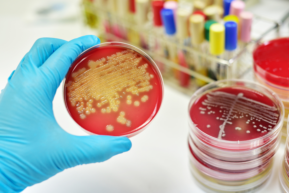 Impact eindejaarsregeling Sciensano op monsternames voor Salmonella en aviaire influenza