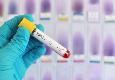 Amerikaanse minister van Volksgezondheid schrapt 760.000.000 dollar subsidie voor vogelgriepvaccin bij mensen