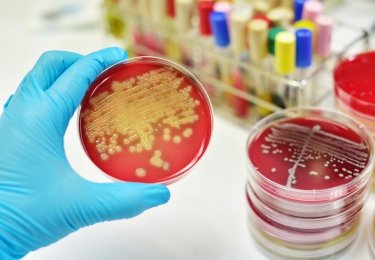Impact eindejaarsregeling Sciensano op monsternames voor Salmonella en aviaire influenza