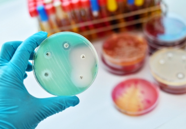 Internationale week van de sensibilisering voor verstandig gebruik van antibiotica: gunstige evoluties in de diergeneeskunde, maar bijzondere aandacht voor de pluimveesector