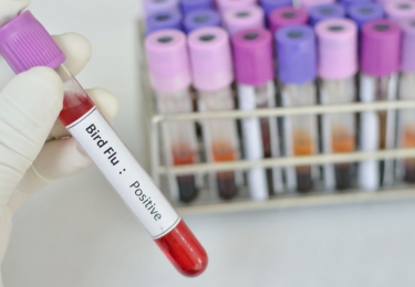Variant van vogelgriepvirus voor het eerst overgesprongen op mensen in Rusland